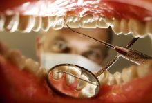 How Often Should You Have a Dental Cleaning